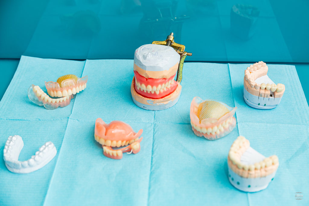 impjante_dentare1 impjante_dentare1